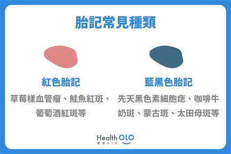 小腿有胎記|胎記怎麼產生、何時消除？醫師剖析胎記種類、胎記寓意